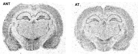 H1 receptor expression in ANT and AT rats