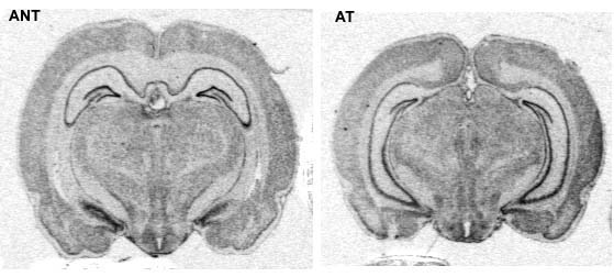 H2 receptor expression in ANT and AT rats